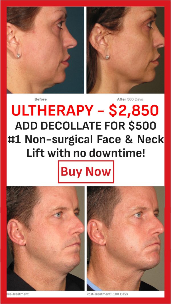 ULTHERAPYULTHERAPY and add Decollate